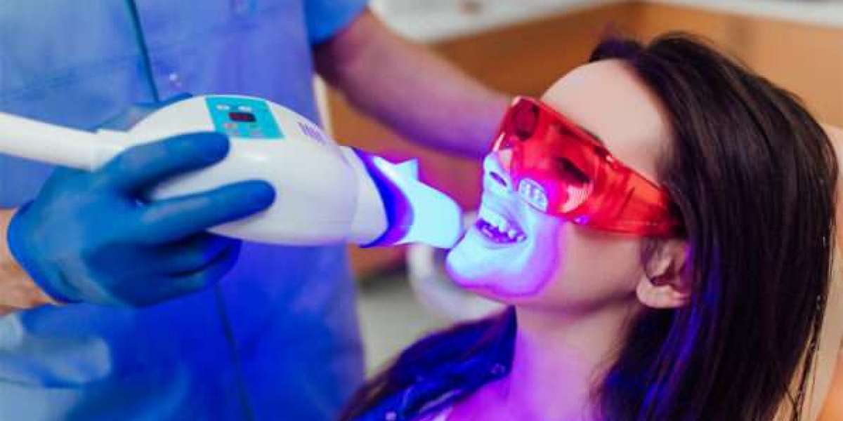 Is Teeth Whitening Worth It? Honest Answers Inside