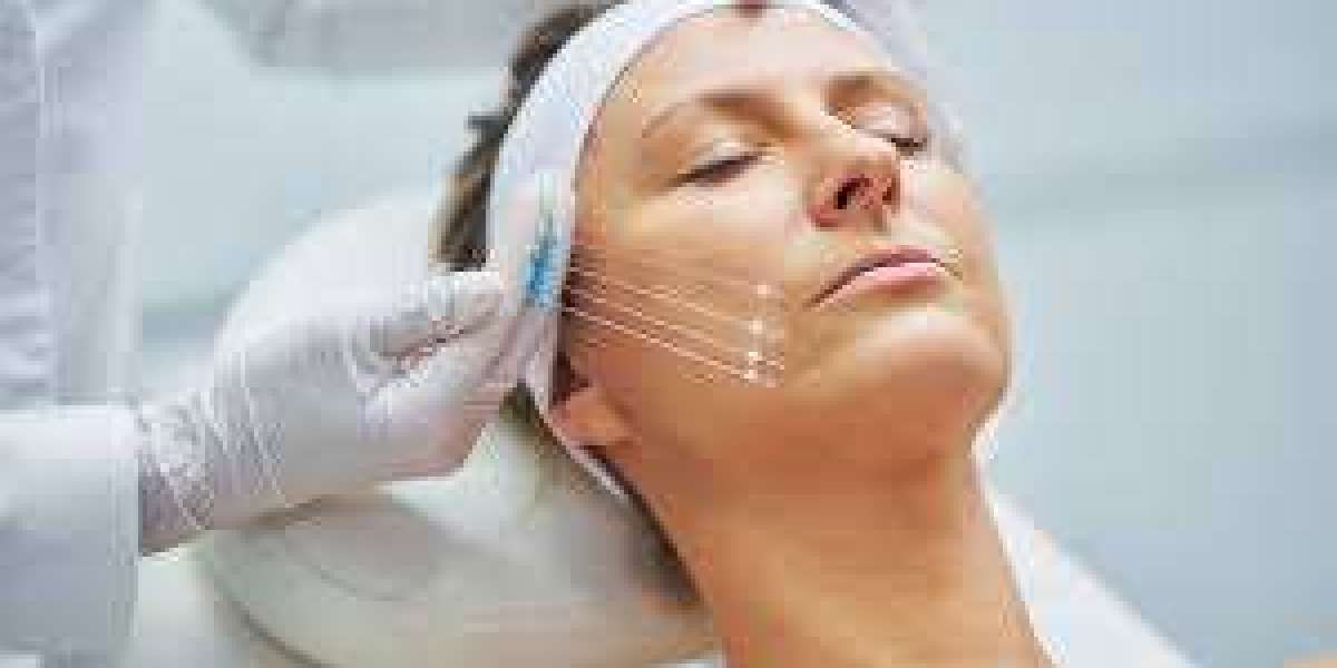 Thread Lift in Dubai – Natural Facial Rejuvenation Without Surgery or Downtime