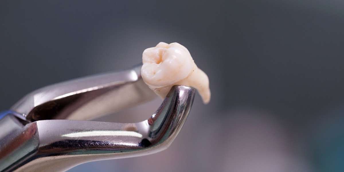 Pain-Free Tooth Extraction for Kids: A Complete Parent’s Guide