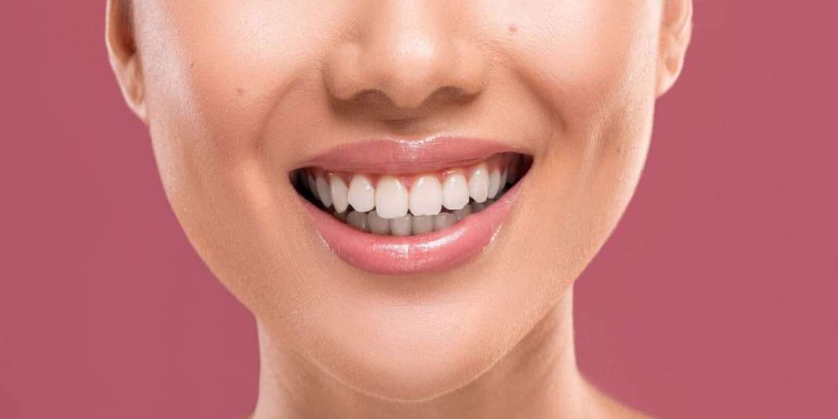 How Long Does a Smile Makeover Really Last? Real Expectations Explained