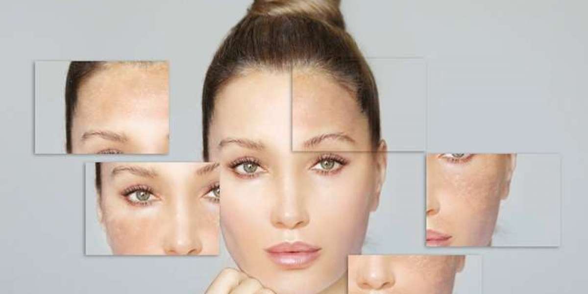 Pigmentation Treatment in Delhi: Effective Solutions for Clear and Even Skin