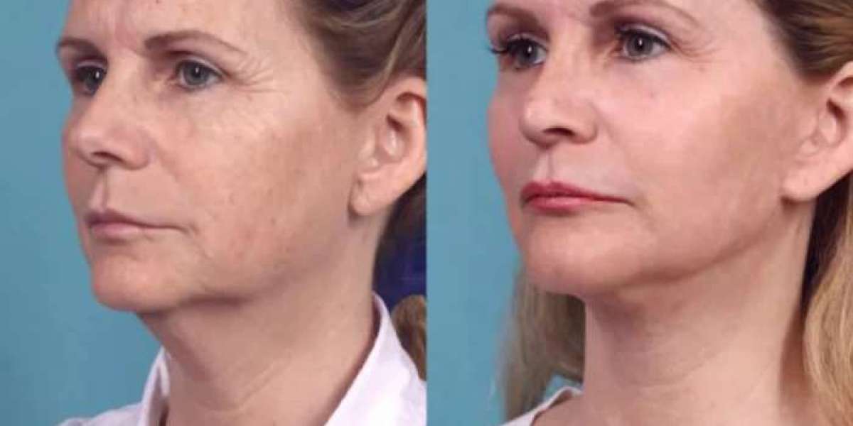 Best Plastic Surgeons in Dubai for Professional Results
