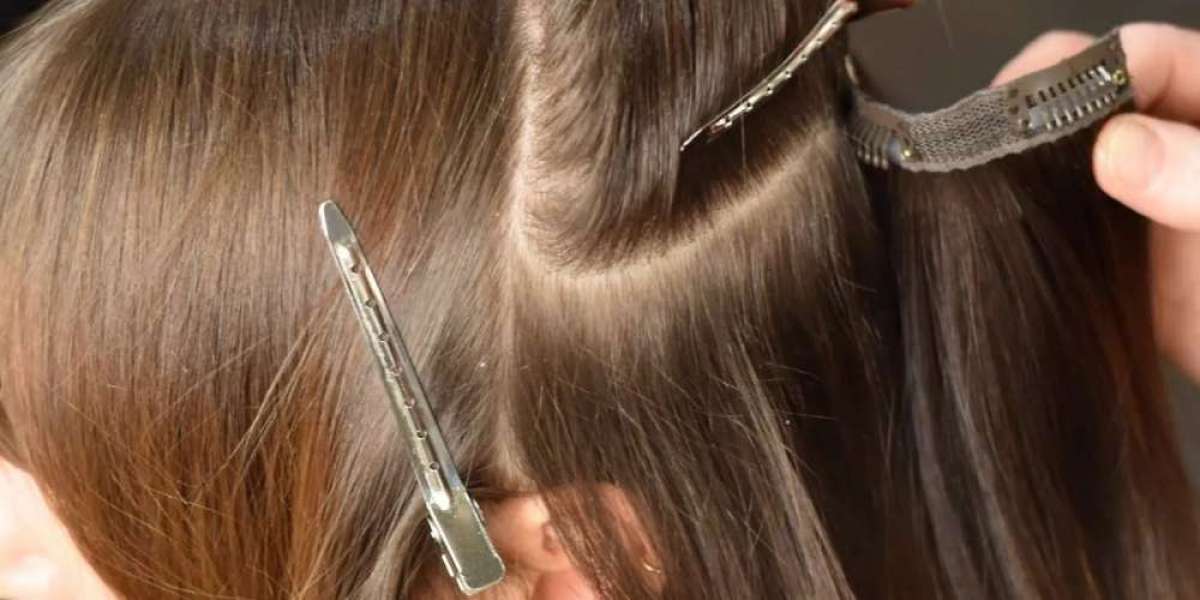Private Hair Loss Consultation Dallas