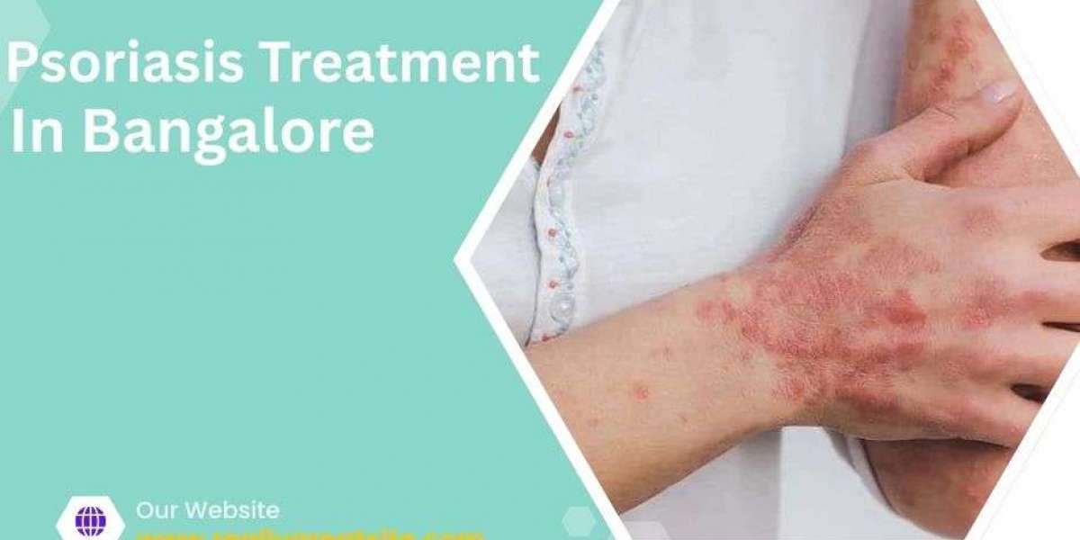 How to Build a Skincare Routine for Sensitive Psoriatic Skin
