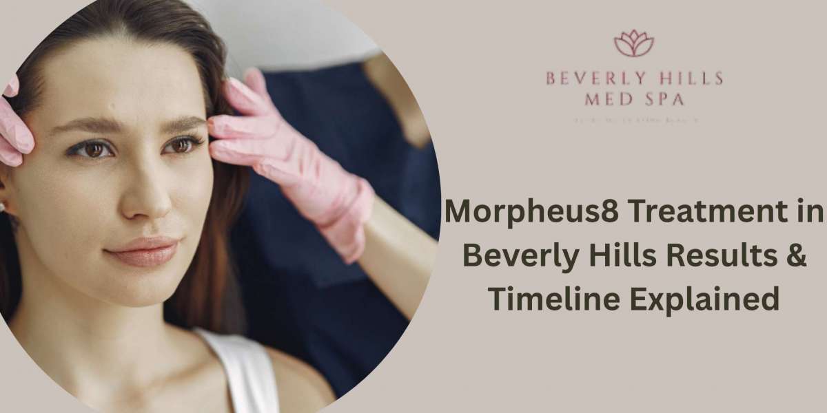 Morpheus8 Treatment in Beverly Hills Results & Timeline Explained