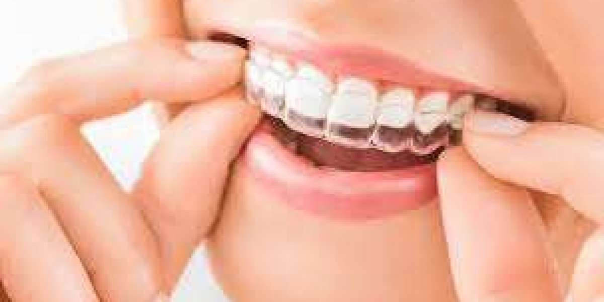 How Dental Crowns Protect the Pulp and Prevent Further Tooth Degeneration