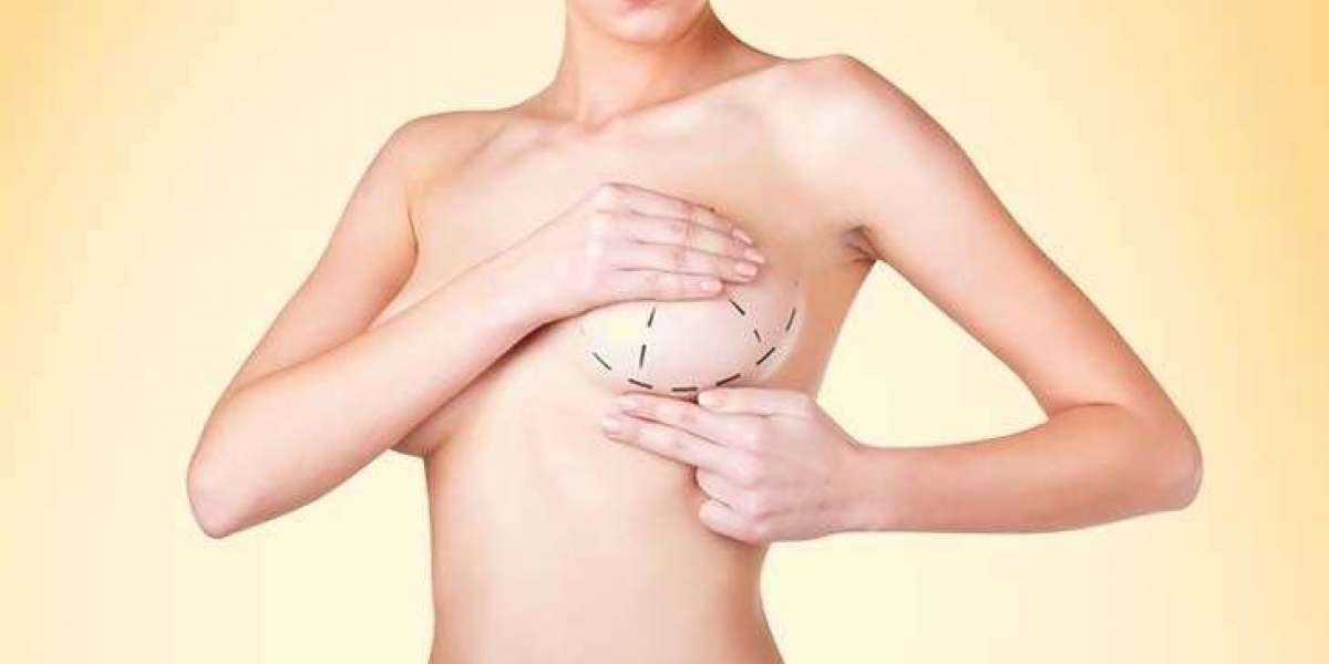 Dubai Breast Surgery Consultation Services – Your Guide to Safe and Confident Cosmetic Decisions