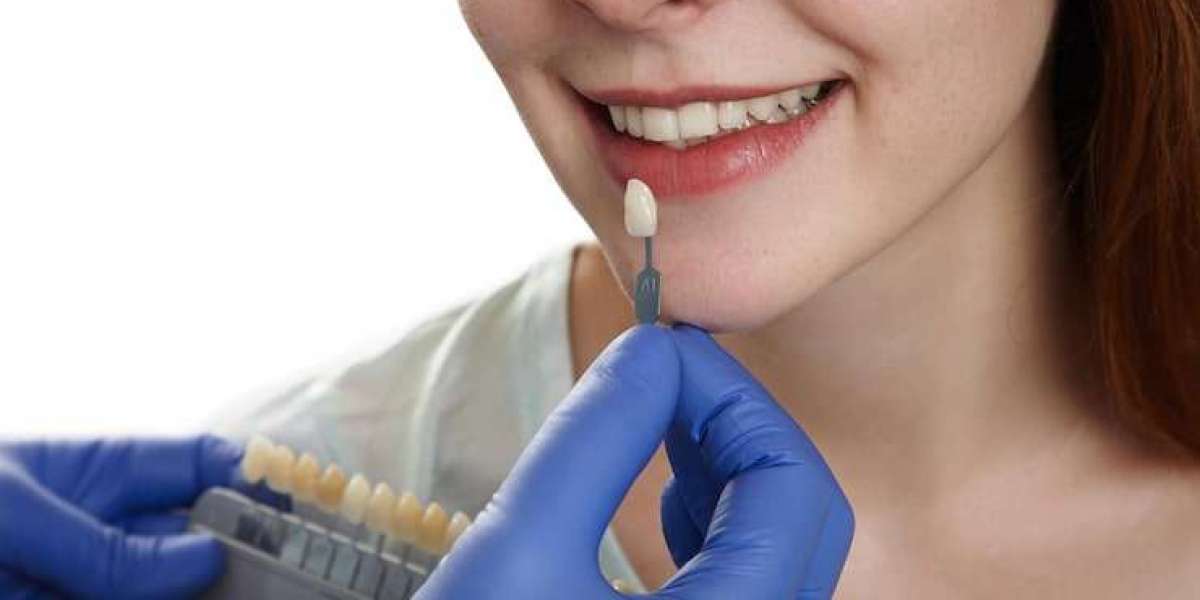 Restoring Confidence with High-Quality Dental Caps