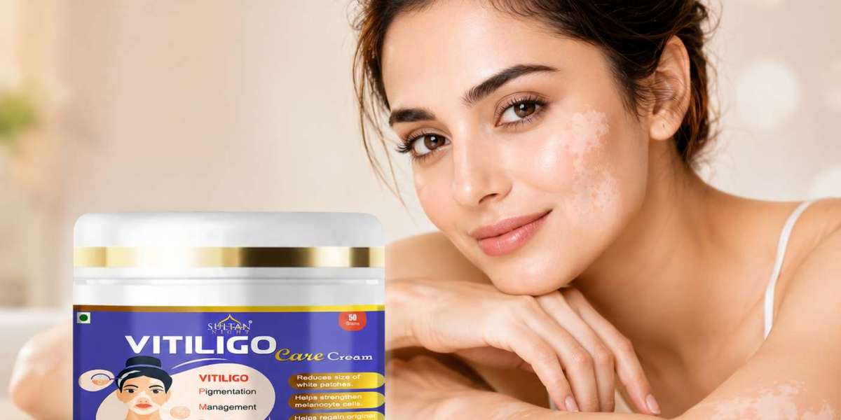 What Happens When You Use Vitiligo Cream Regularly?