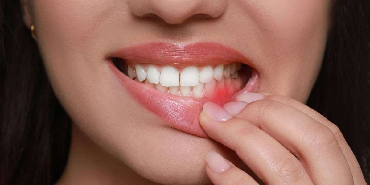 Laser Dentistry for Gum Problems: Is It Better Than Traditional Treatment?