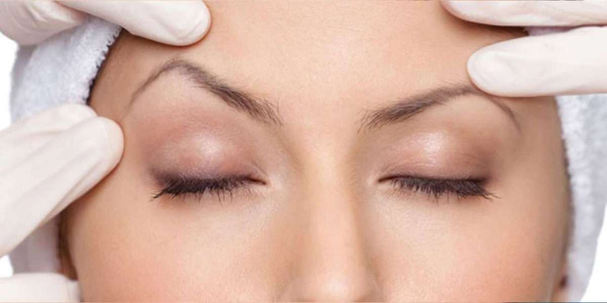 Endoscopic Brow Lift in Riyadh: A Minimally Invasive Path to Rejuvenation
