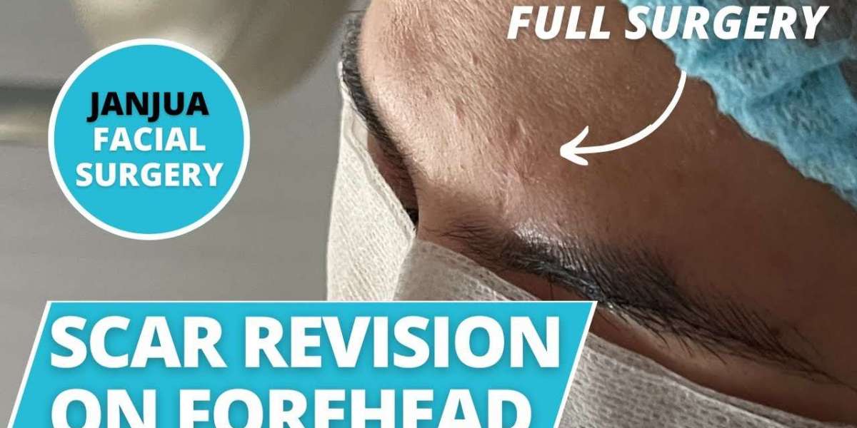 Understanding Different Scar Types: Keloids, Hypertrophic, and Contractures
