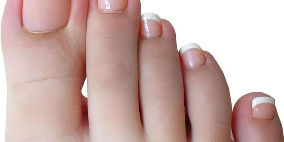 Fungexin Pen: Moderne Pflege für Haut- und Nagelgesundheit