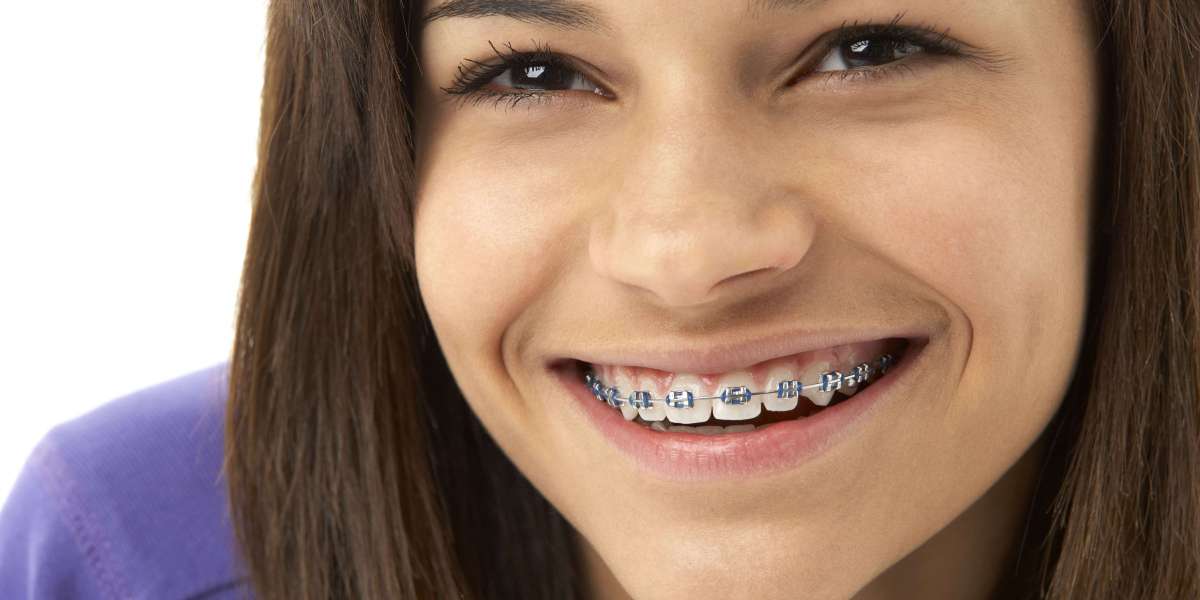 Life With Braces: Tips For Eating, Cleaning, And Staying Comfortable