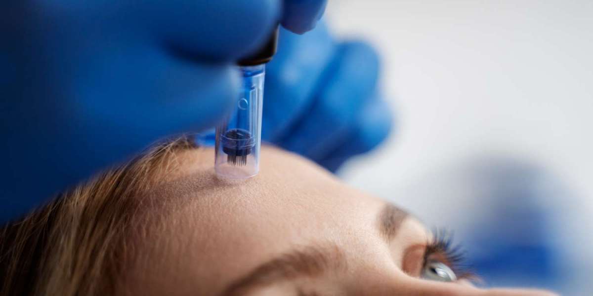 Skinpen Microneedling in Altrincham for Sensitive Skin: Is It Suitable?