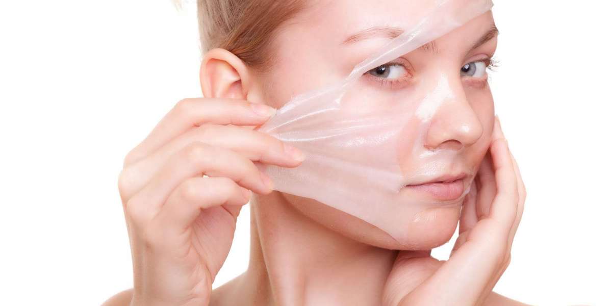 How many sessions of chemical peels are needed?