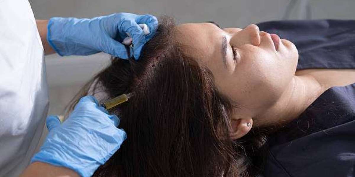 PRP Hair Therapy in Islamabad – A Natural Solution for Hair Regrowth