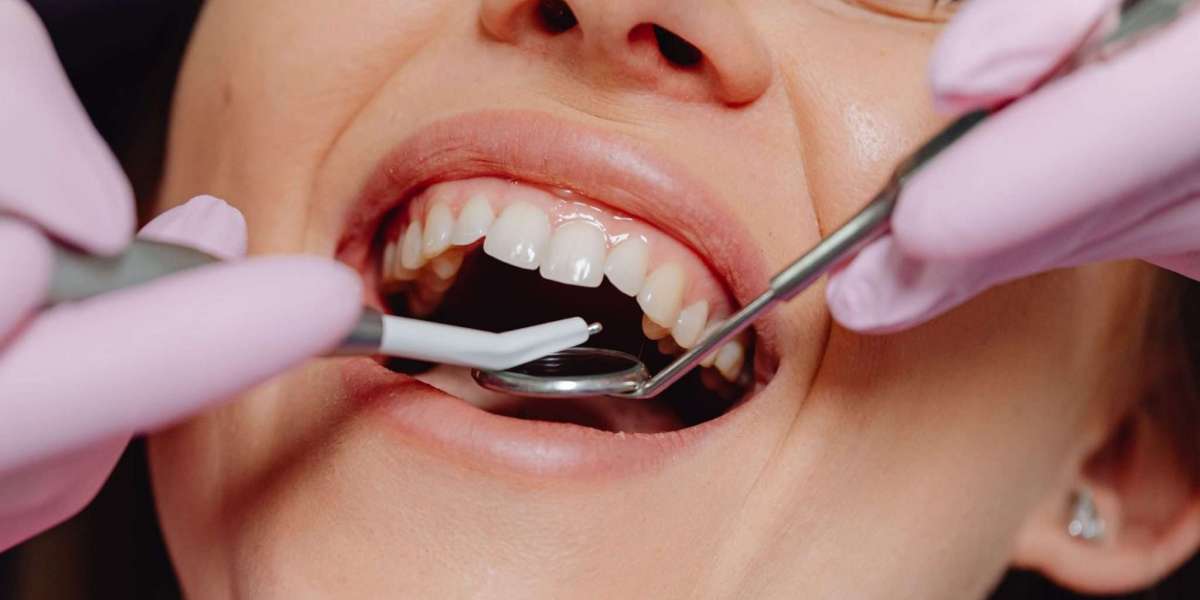 Emergency Dentist Killara – Fast Relief from Dental Emergencies