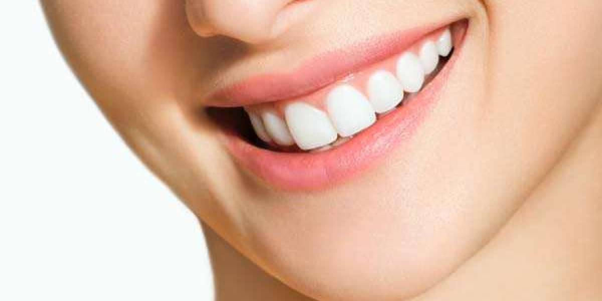 Cosmetic Dentistry in Sioux Falls, SD for Healthy Smiles