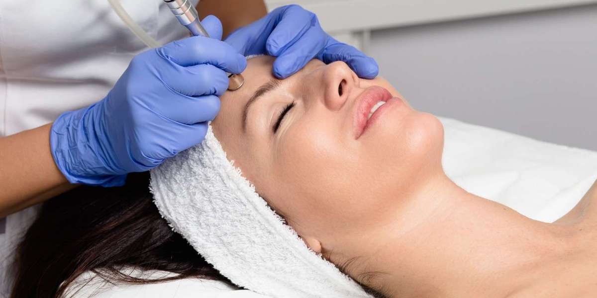 Improve Acne Scars With Treatment