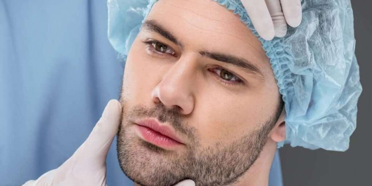 Beard Hair Transplant and the Future of Facial Hair Restoration