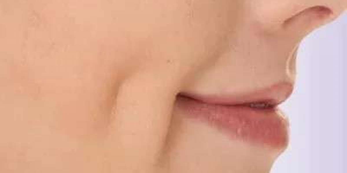 What Is Dimple Creation in Islamabad and How Does It Work?