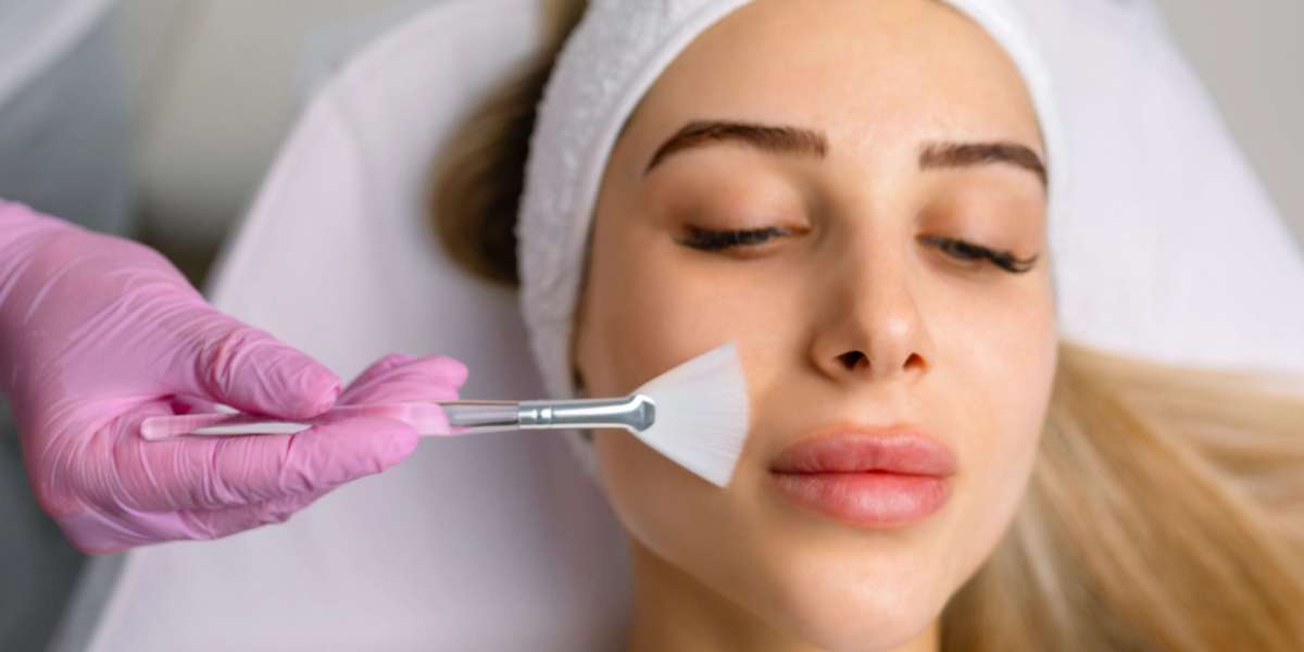 Best Types of Chemical Peels in Islamabad for Every Skin Type