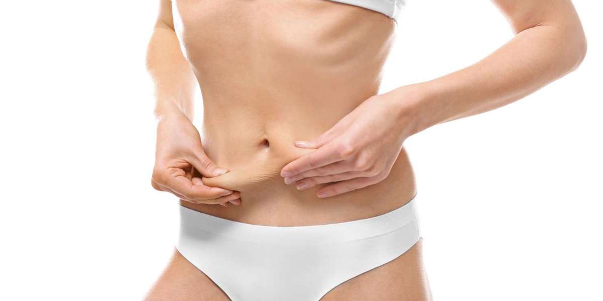 Liposuction in Dubai for Smooth and Defined Curves