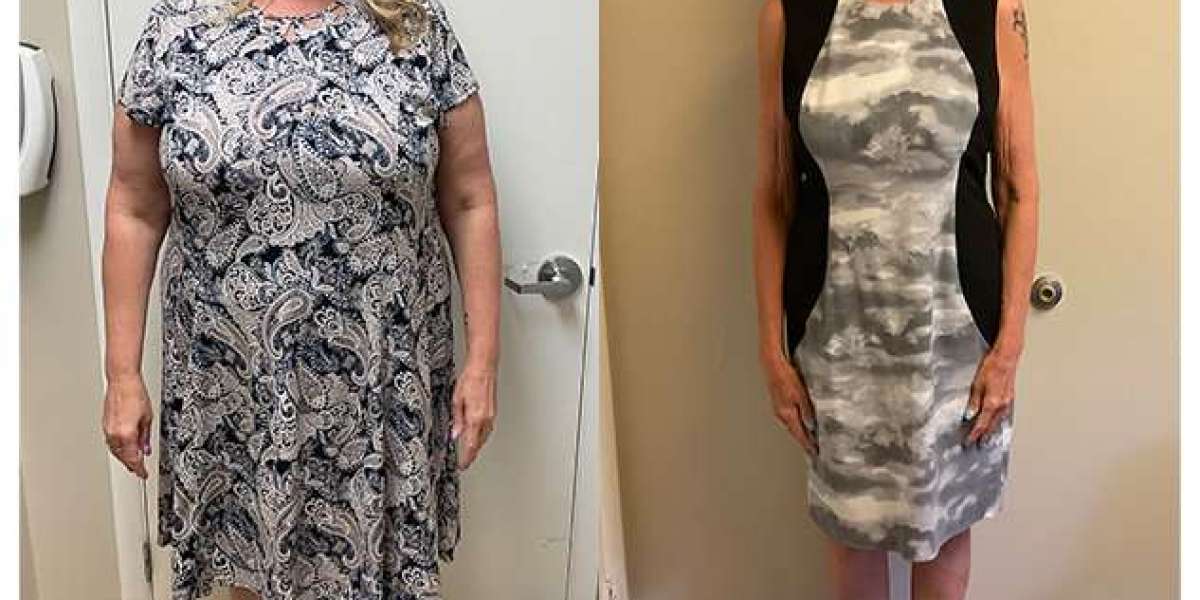 The Real Cost and Access Tradeoffs Behind Greensboro Weight Loss
