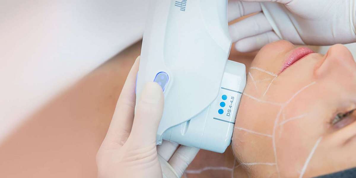 Understanding the Cost of Ultherapy Treatment for Skin Tightening