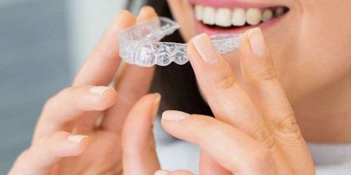 What Affects the Price of Clear Aligners and Invisible Braces Treatment?