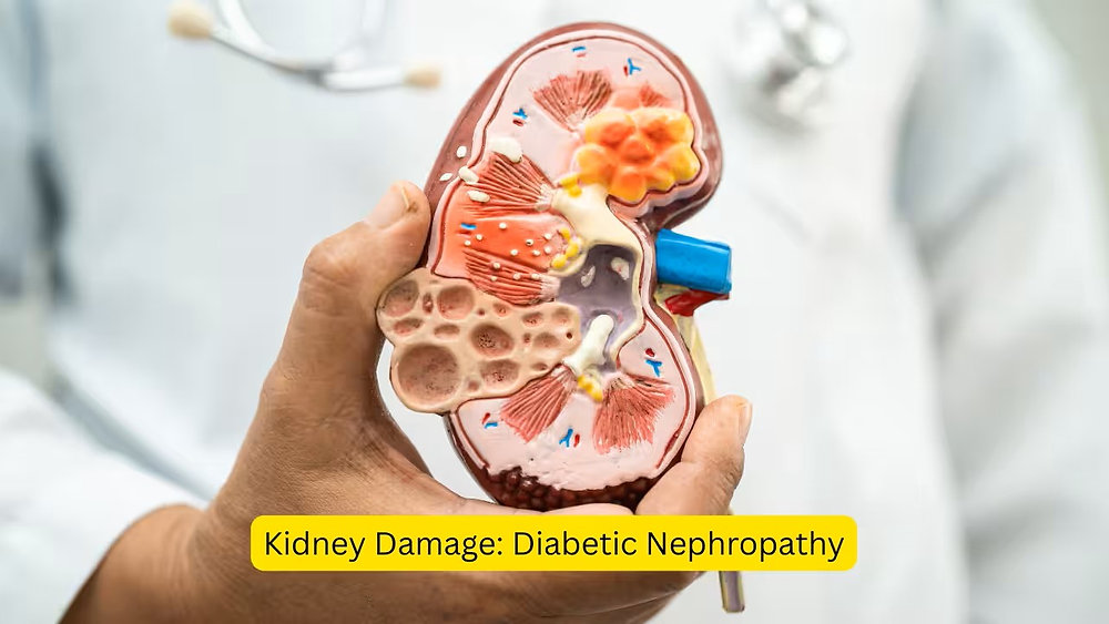 Cardiac Diabetic PCD Company: A Powerful Model for Business Expansion