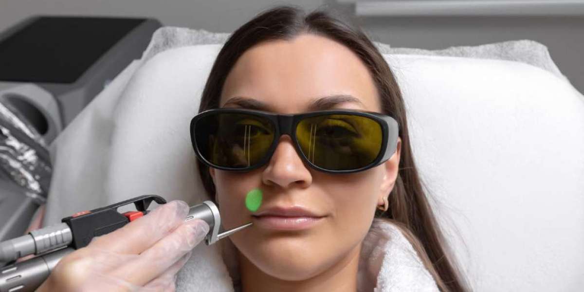 CO2 Laser In Manchester – Advanced Skin Resurfacing for Deep Renewal Results
