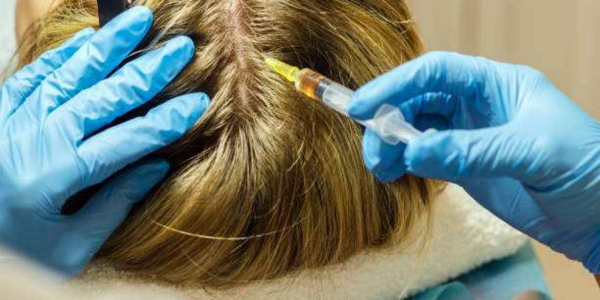 FUE Hair Transplant in Islamabad – Advanced Technique for Natural and Permanent Hair Regrowth