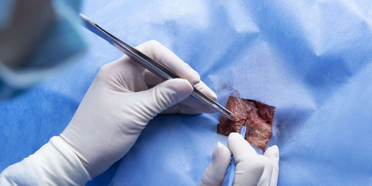 Is Surgical Debridement Painful? Everything Patients Need to Know
