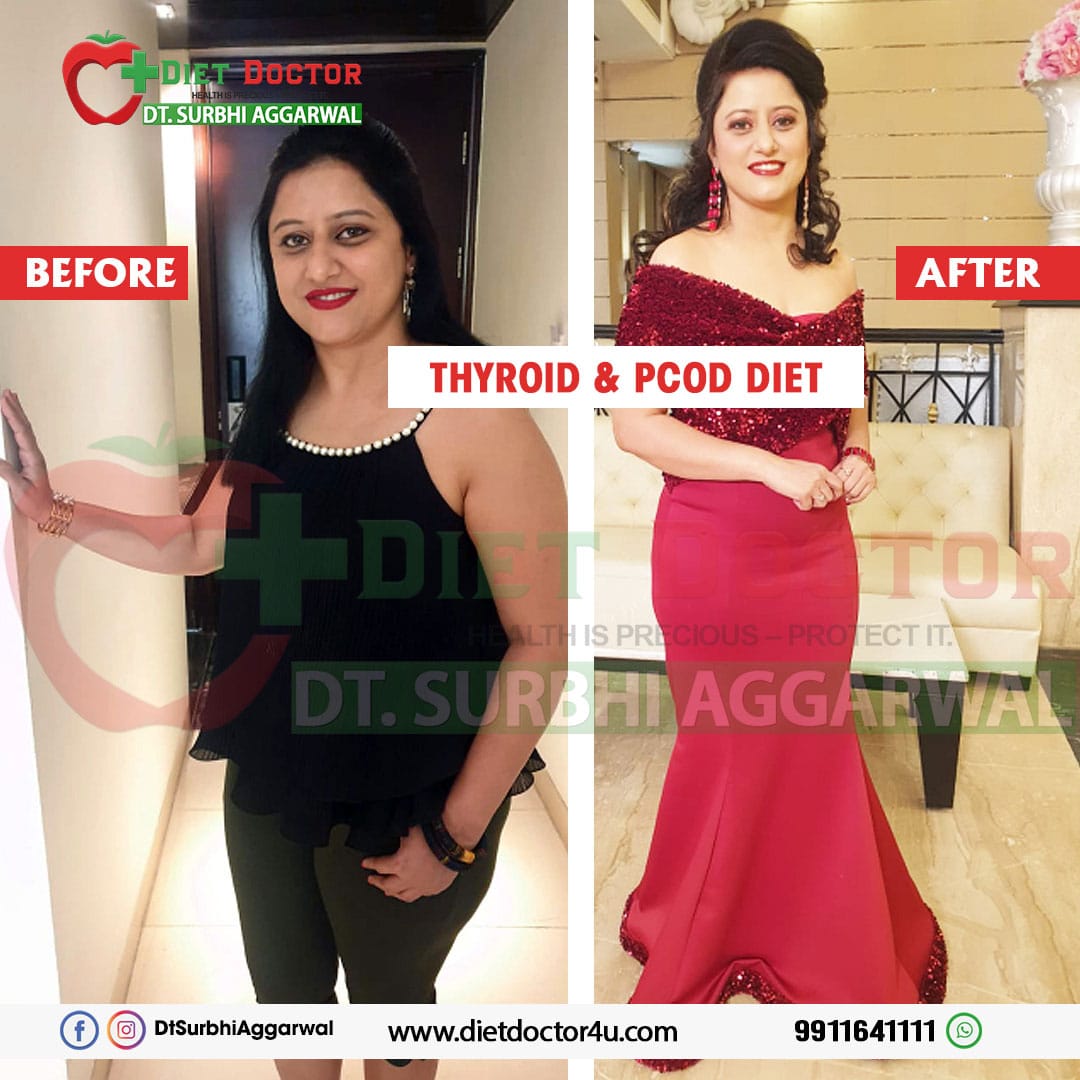 Best Dietician and Nutritionist in Model Town | Dietitian Surbhi
