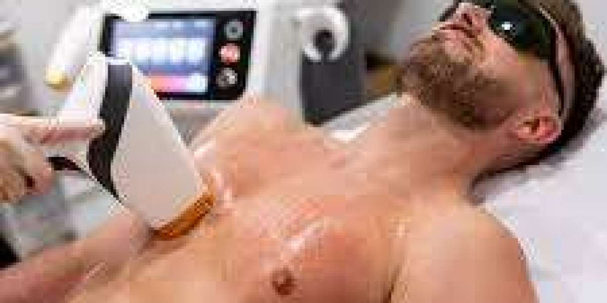 Body Hair Removal in Dubai: Modern Solutions for Smooth and Long-Lasting Skin