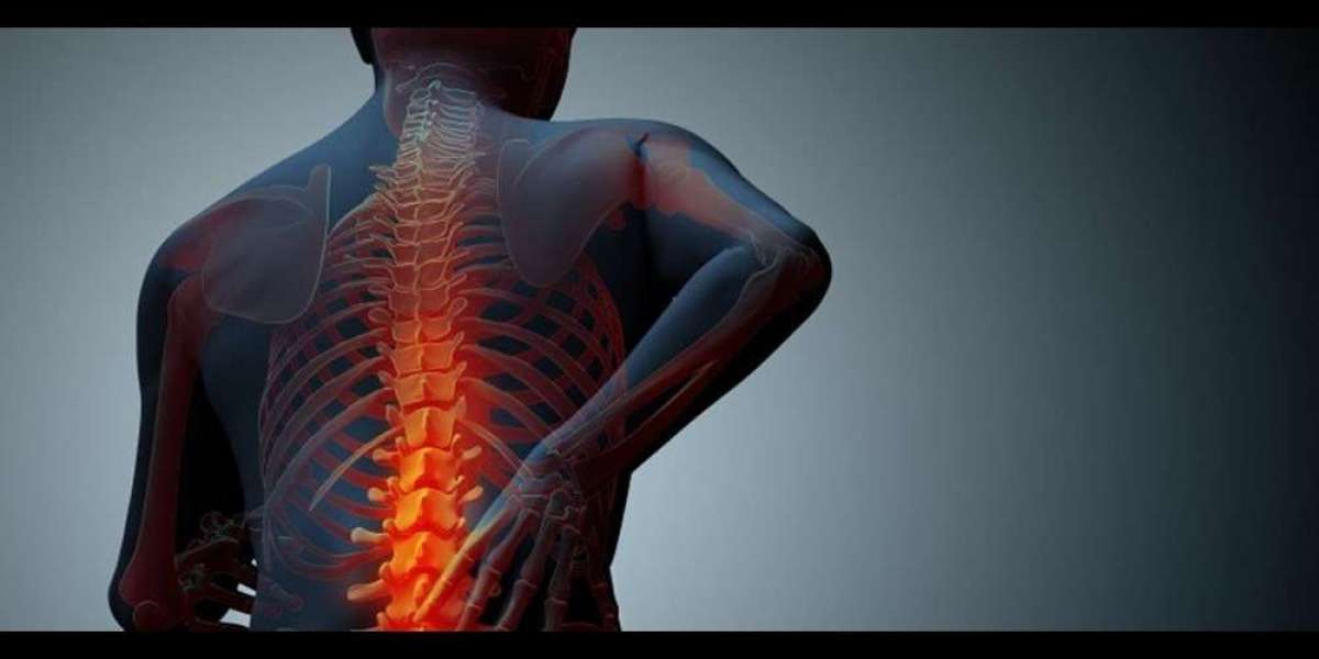 Epidural Injection Price in Punjab: What You Need to Know Before Your Treatment
