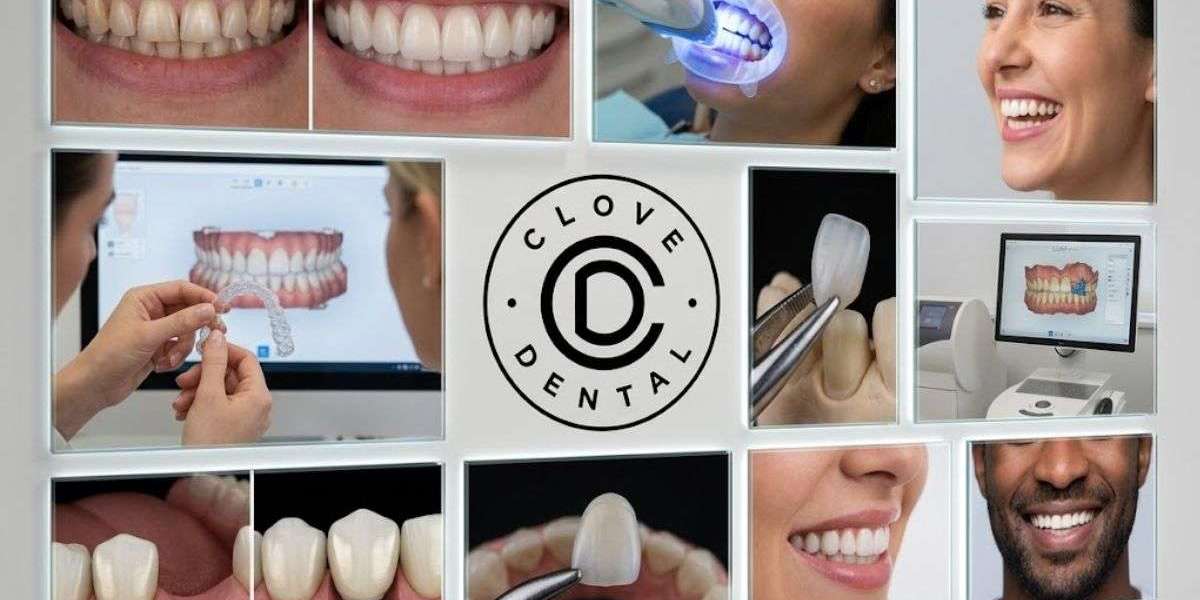 Recovery Tips After Tooth Extraction: Advice From Best Ventura Dentist