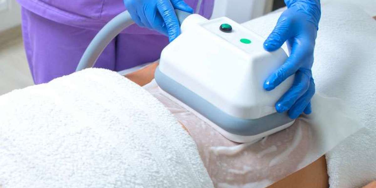 Radiant body upgrade using CoolSculpting for a refined silhouette look