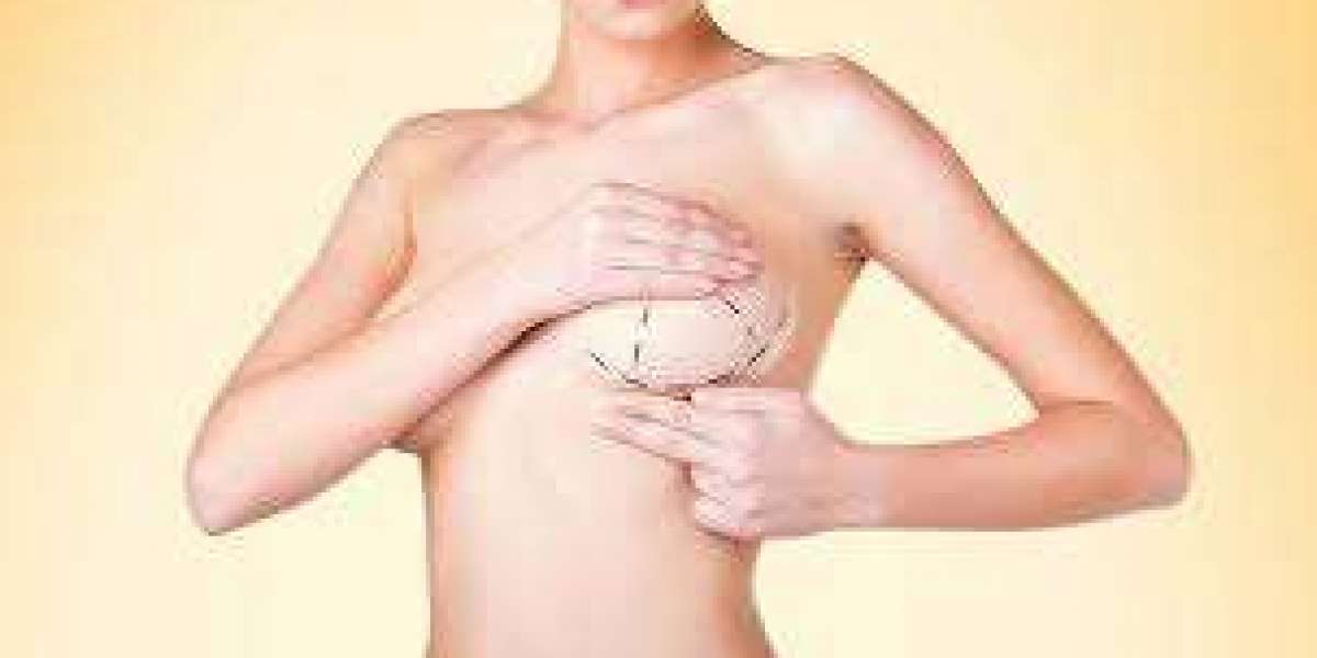 Breast Enlargement in Dubai: Advanced Cosmetic Options for Enhanced Curves