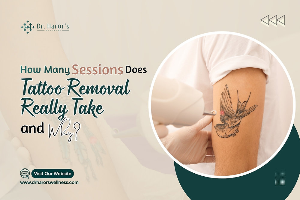 How Many Sessions Does Tattoo Removal Really Take—and Why
