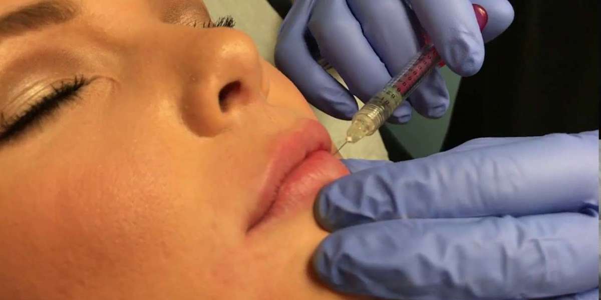 How Does Restylane Improve Skin Appearance Naturally?