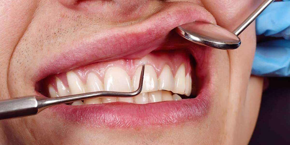 Signs You May Need Professional Periodontal Treatment