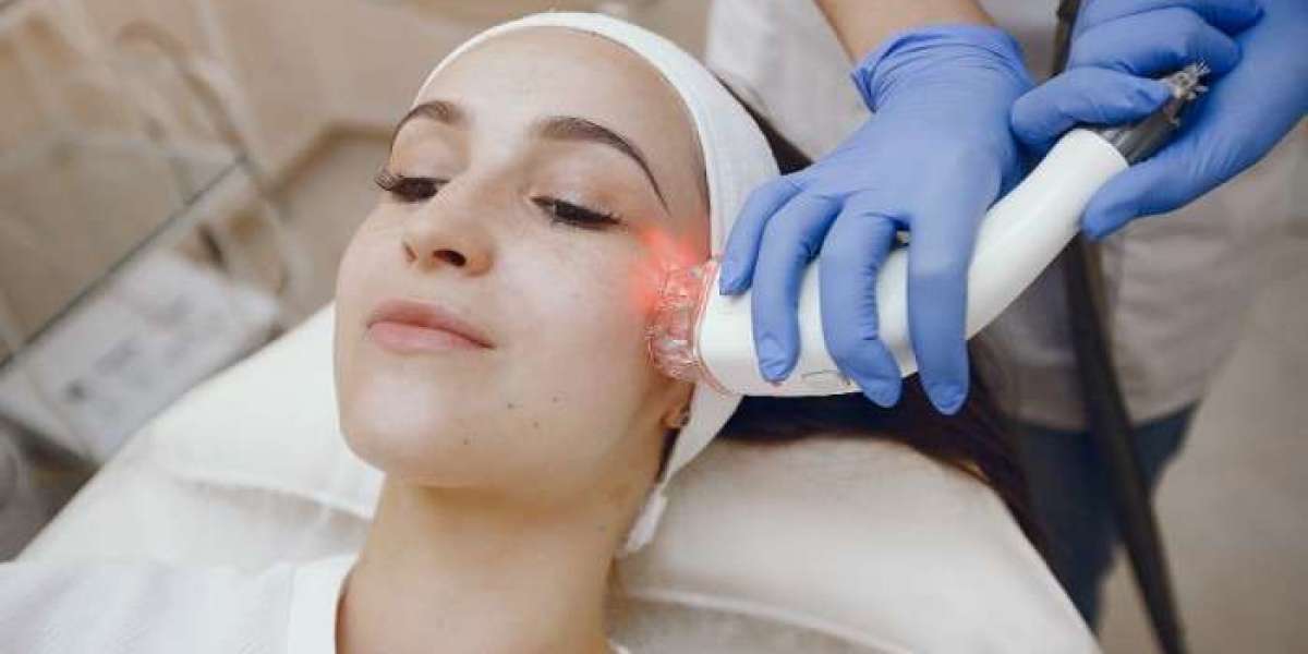 Laser Facial: Discover the Benefits of Advanced Skin Resurfacing for a Youthful Appearance