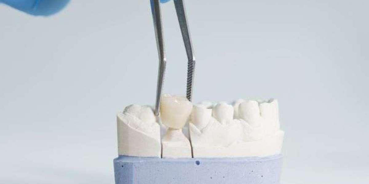 Dental Crown vs Filling: Understanding the Key Differences