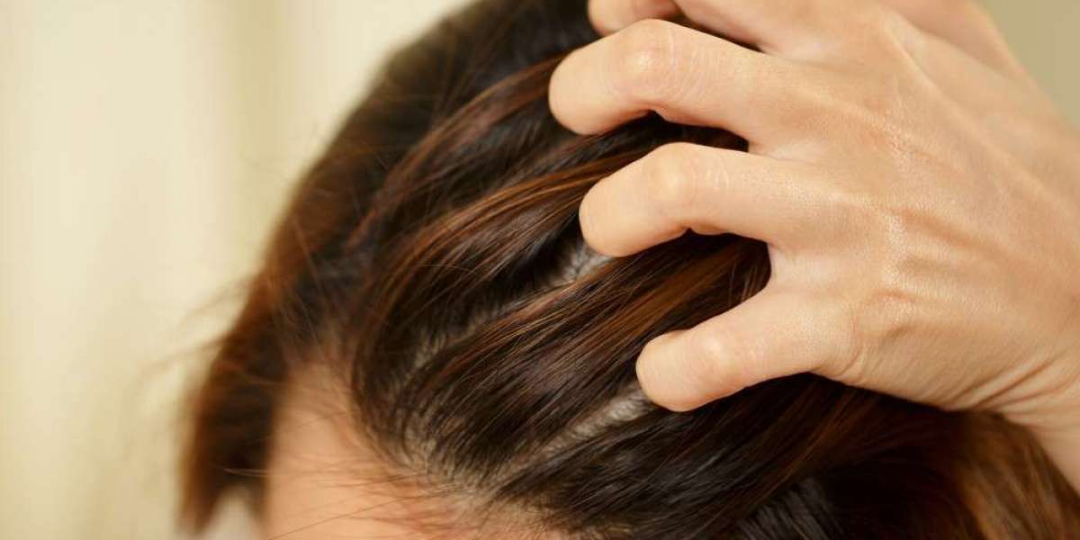 Best Anti-Dandruff and Hair Fall Control Shampoo for Healthy Hair