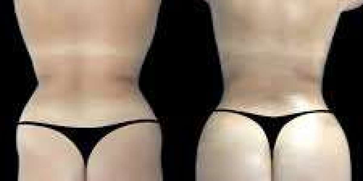 Best Doctors in Dubai for Comprehensive Body Enhancement