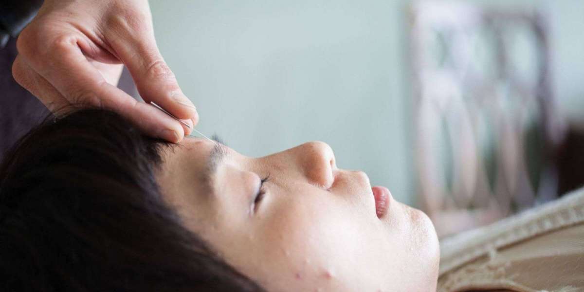 Oakland Acupuncture Clinic: Your First Facial Session