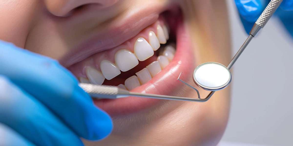 Cosmetic Bonding in San Antonio, TX